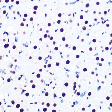 Anti-DDX5 antibody produced in rabbit