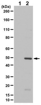 Anti-phospho-Keratin-20 Antibody (Ser13) from rabbit, purified by affinity chromatography