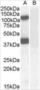 Anti-EPB41L2 /4.1G (AA 593-604) antibody produced in goat affinity isolated antibody, buffered aqueous solution