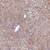 Anti-EXT1 antibody produced in rabbit Prestige Antibodies&#174; Powered by Atlas Antibodies, affinity isolated antibody, buffered aqueous glycerol solution
