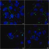 Monoclonal Anti-Tarp antibody produced in mouse clone S245-36, purified immunoglobulin