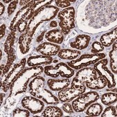 Anti-GSTM1 antibody produced in rabbit Prestige Antibodies&#174; Powered by Atlas Antibodies, affinity isolated antibody, buffered aqueous glycerol solution