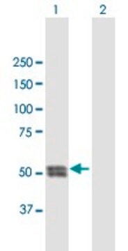 Anti-CTSC antibody produced in mouse purified immunoglobulin, buffered aqueous solution