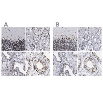 Anti-TPR antibody produced in rabbit Prestige Antibodies&#174; Powered by Atlas Antibodies, affinity isolated antibody, buffered aqueous glycerol solution