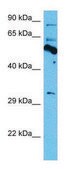 Anti-THRA antibody produced in rabbit affinity isolated antibody