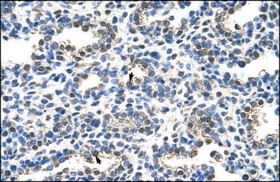 Anti-EIF2S1 antibody produced in rabbit IgG fraction of antiserum
