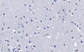 Anti-HDAC3 Antibody, clone 1H19 ZooMAb&#174; Rabbit Monoclonal recombinant, expressed in HEK 293 cells