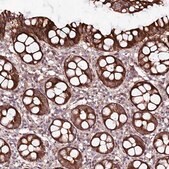 Anti-PHLDB1 antibody produced in rabbit Prestige Antibodies&#174; Powered by Atlas Antibodies, affinity isolated antibody, buffered aqueous glycerol solution