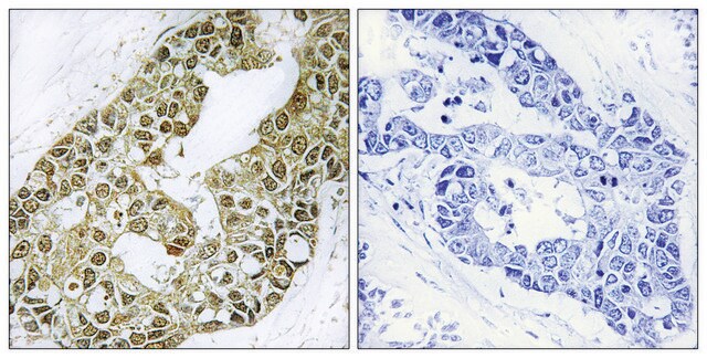 Anti-I&#954;B-&#945; antibody produced in rabbit affinity isolated antibody