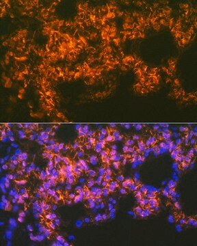 Anti-Mesothelin Antibody, clone 5R9H8, Rabbit Monoclonal
