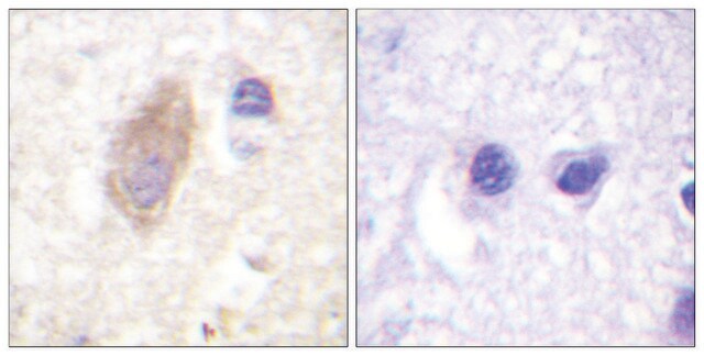 Anti-Rabphilin 3A antibody produced in rabbit affinity isolated antibody