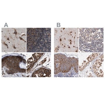 Anti-KTN1 antibody produced in rabbit Prestige Antibodies&#174; Powered by Atlas Antibodies, affinity isolated antibody, buffered aqueous glycerol solution