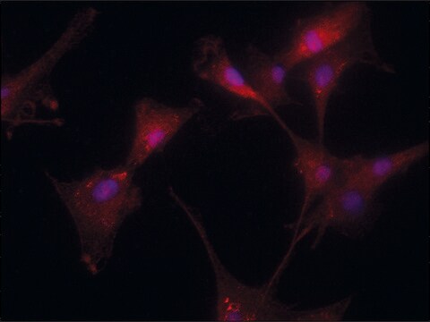 Anti-Transglutaminase-2 (C-terminal) antibody produced in rabbit ~1.5&#160;mg/mL, affinity isolated antibody