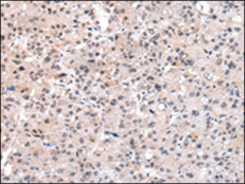 Anti-SETMAR affinity isolated antibody