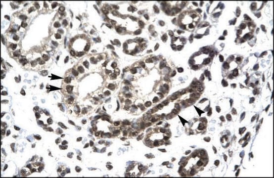 Anti-PTHLH antibody produced in rabbit IgG fraction of antiserum