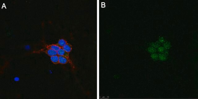 Anti-Pyk2/CAK&#946; Antibody
