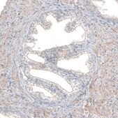 Anti-FGFR2 antibody produced in rabbit Prestige Antibodies&#174; Powered by Atlas Antibodies, affinity isolated antibody, buffered aqueous glycerol solution