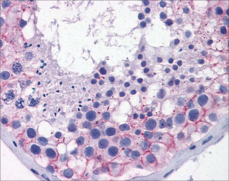 Anti-TJP1 antibody produced in rabbit affinity isolated antibody