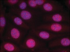 Anti-ESR1 (Ab-118) antibody produced in rabbit affinity isolated antibody