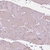 Anti-FASN antibody produced in rabbit Prestige Antibodies&#174; Powered by Atlas Antibodies, affinity isolated antibody, buffered aqueous glycerol solution