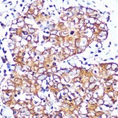 Anti-Muscarinic AChR M2 (ACM2) Antibody, clone 3T5W8, Rabbit Monoclonal