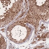 Anti-PSMA1 antibody produced in rabbit Prestige Antibodies&#174; Powered by Atlas Antibodies, affinity isolated antibody, buffered aqueous glycerol solution