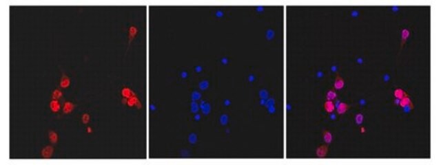 Anti-NeuN (rabbit monoclonal) Antibody, clone 27-4 clone 27-4, from rabbit