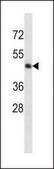 ANTI-MOUSE MAP2K5 (C-TERM) antibody produced in rabbit IgG fraction of antiserum, buffered aqueous solution