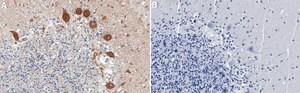 Anti-Maxi K/BK channel Antibody, clone 3D15 ZooMAb&#174; Rabbit Monoclonal recombinant, expressed in HEK 293 cells