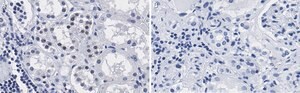 Anti-PARP-1 Antibody, clone 12N17 Antibody, ZooMAb&#174; Rabbit Monoclonal recombinant, expressed in HEK 293 cells