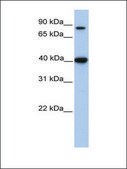 Anti-ACAT1 antibody produced in rabbit affinity isolated antibody