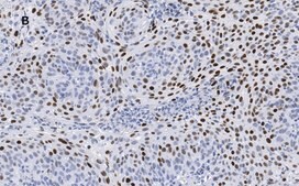 Anti-p21 Antibody, clone 5G7, ZooMAb&#174; Rabbit Monoclonal recombinant, expressed in HEK 293 cells