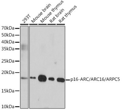 Anti-p16-ARC/ARC16/ARPC5 Antibody, clone 7W9M7, Rabbit Monoclonal
