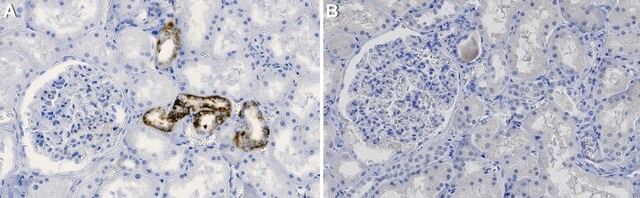 Anti-cPLA2 Antibody, clone 2F4 ZooMAb&#174; Rabbit Monoclonal recombinant, expressed in HEK 293 cells