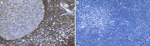 Anti-PKC&#946; Antibody, clone 2E13 ZooMAb&#174; Rabbit Monoclonal recombinant, expressed in HEK 293 cells
