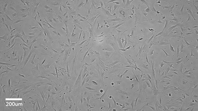 Normal Human Hepatic Stellate Cells; passage 2 Single-Donor Cryopreserved Stellate cells isolated from human livers, high viability, and characterized by cell specific markers