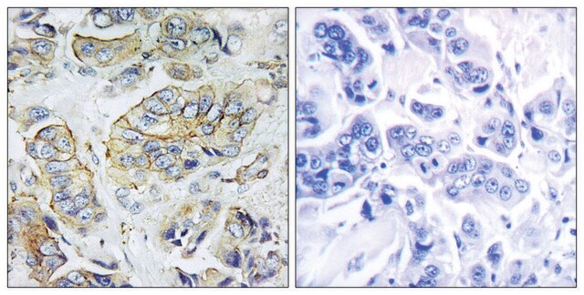 Anti-NPY5R antibody produced in rabbit affinity isolated antibody