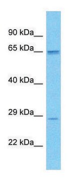 Anti-SCD5 antibody produced in rabbit affinity isolated antibody