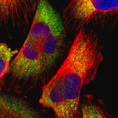 Anti-CDK3 antibody produced in rabbit Prestige Antibodies&#174; Powered by Atlas Antibodies, affinity isolated antibody, buffered aqueous glycerol solution