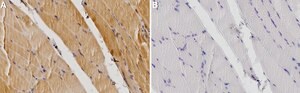 Anti-CHRNA1/ACHRA Antibody, clone 2G22 ZooMAb&#174; Rabbit Monoclonal recombinant, expressed in HEK 293 cells