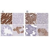 Anti-TNNC1 antibody produced in rabbit Prestige Antibodies&#174; Powered by Atlas Antibodies, affinity isolated antibody, buffered aqueous glycerol solution
