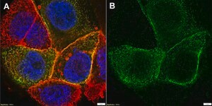 Anti-CFTR Antibody, clone MM13-4 ZooMAb&#174; Mouse Monoclonal recombinant, expressed in HEK 293 cells