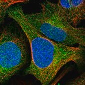Anti-GCLM antibody produced in rabbit affinity isolated antibody, buffered aqueous glycerol solution