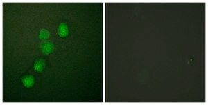 Anti-Cyclin E1 antibody produced in rabbit affinity isolated antibody