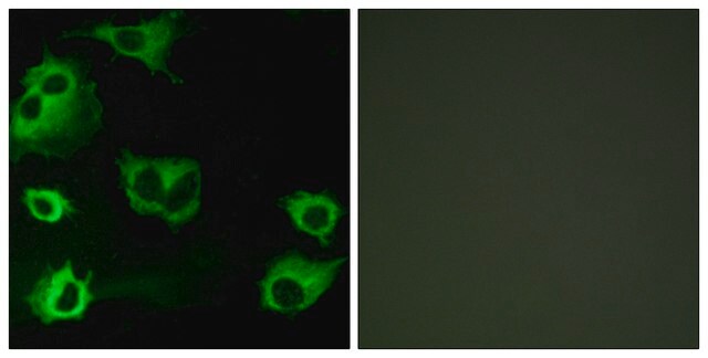 Anti-CYSLTR1 antibody produced in rabbit affinity isolated antibody