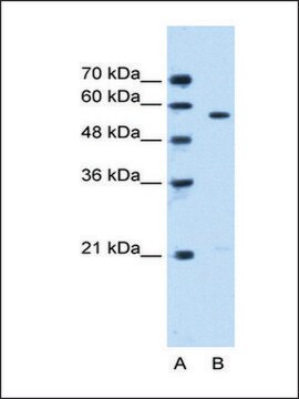 Anti-STK3 antibody produced in rabbit affinity isolated antibody