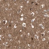 Anti-NAPG antibody produced in rabbit Prestige Antibodies&#174; Powered by Atlas Antibodies, affinity isolated antibody, buffered aqueous glycerol solution