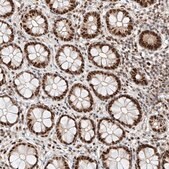 Anti-HDAC9 antibody produced in rabbit Prestige Antibodies&#174; Powered by Atlas Antibodies, affinity isolated antibody, buffered aqueous glycerol solution