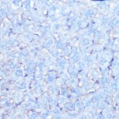 Anti-Na+/K+-ATPase antibody produced in rabbit