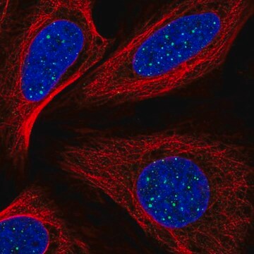 Anti-TINF2 antibody produced in rabbit Prestige Antibodies&#174; Powered by Atlas Antibodies, affinity isolated antibody